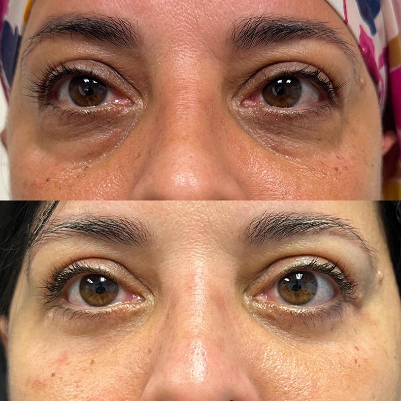 Actual Patient Before After Procedures image