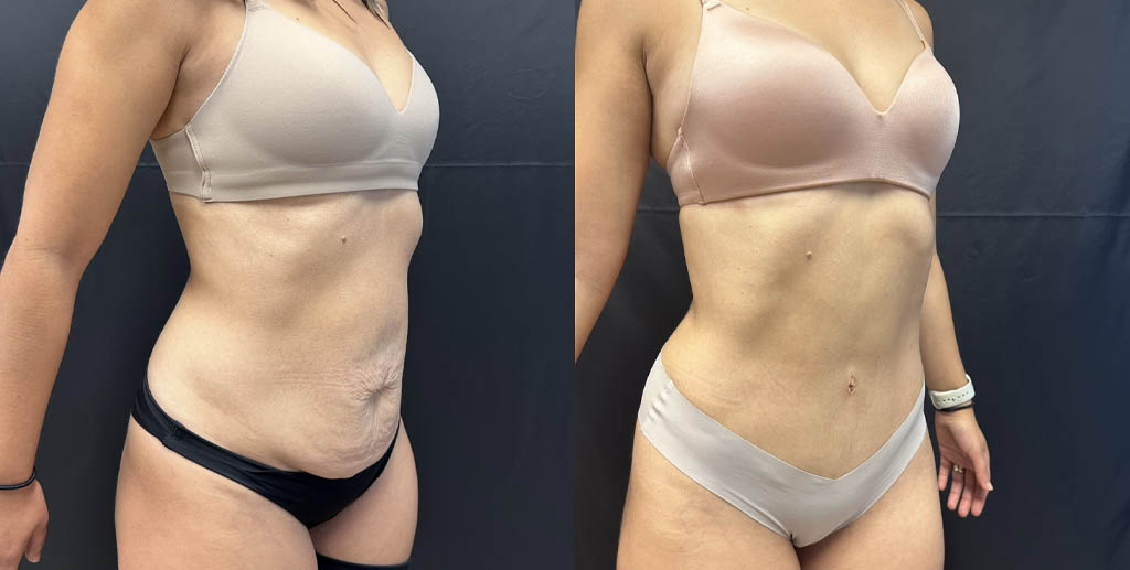 1_0000_ttuck1 (1).jpg