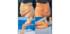 Tummy Tuck case #4103 slider thumbnail