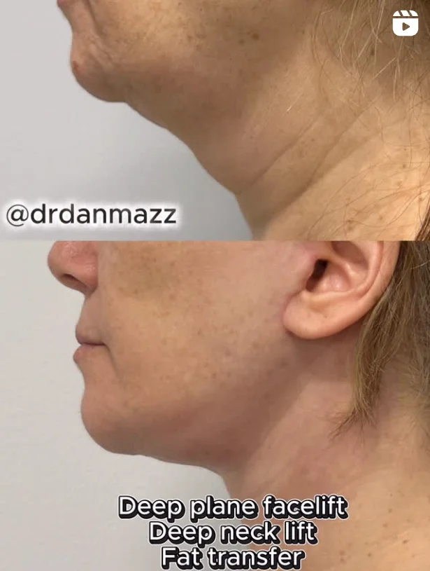 jawline